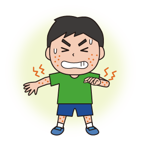 じんましん